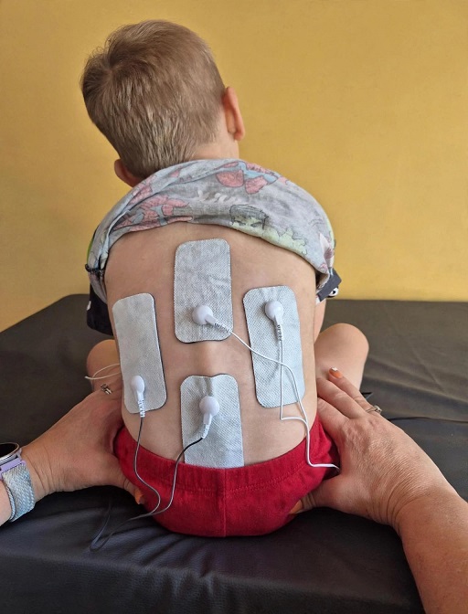 Child receiving specialist paediatric electrical stimulation at Children's Physio Dorset